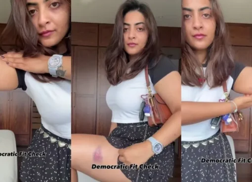 Zayn Marie showing bruises on her arm after a protest.